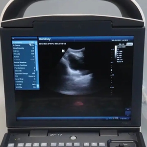 Mindray siêu âm thú y máy siêu âm máy siêu âm màu đen và trắng ecografo DOPPLER DP-10/DP-10 bác sĩ thú y - Product Image 3