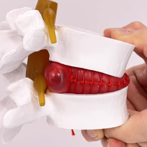 인체 요추 1.5배 확대 척추 의학 교육용 뼈 모형 (인체 요추 디스크 돌출) 의료 학생 실습 교육용 - Product Image 4