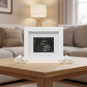 Cadre photo blanc tendance 2026 pour échographie de bébé, boîte de présentation de photos souvenir de grossesse pour la décoration intérieure - Product Image 1