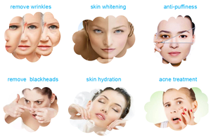 Beco Multi-fonctionnel traitement de l'acné dissolvant de rides hydratant dispositif facial pour lifting du visage - Product Image 3