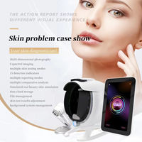 8 Spectrum Bitmoji Skin Analysis Machine Skin Detector Analyzer Face Machine Facial Scanner