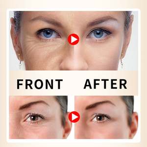 Sérum <span class=keywords><strong>de</strong></span> visage à l'<span class=keywords><strong>extrait</strong></span> <span class=keywords><strong>de</strong></span> riz blanc OEM ODM pour l'élimination antioxydante des taches brunes, liquide <span class=keywords><strong>de</strong></span> soin du visage hydratant et blanchissant anti-âge - Product Image 5