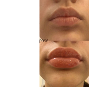 Novedades Extreme Lip Plumper Vegan Lip Volumizer Etiqueta Privada - Product Image 2