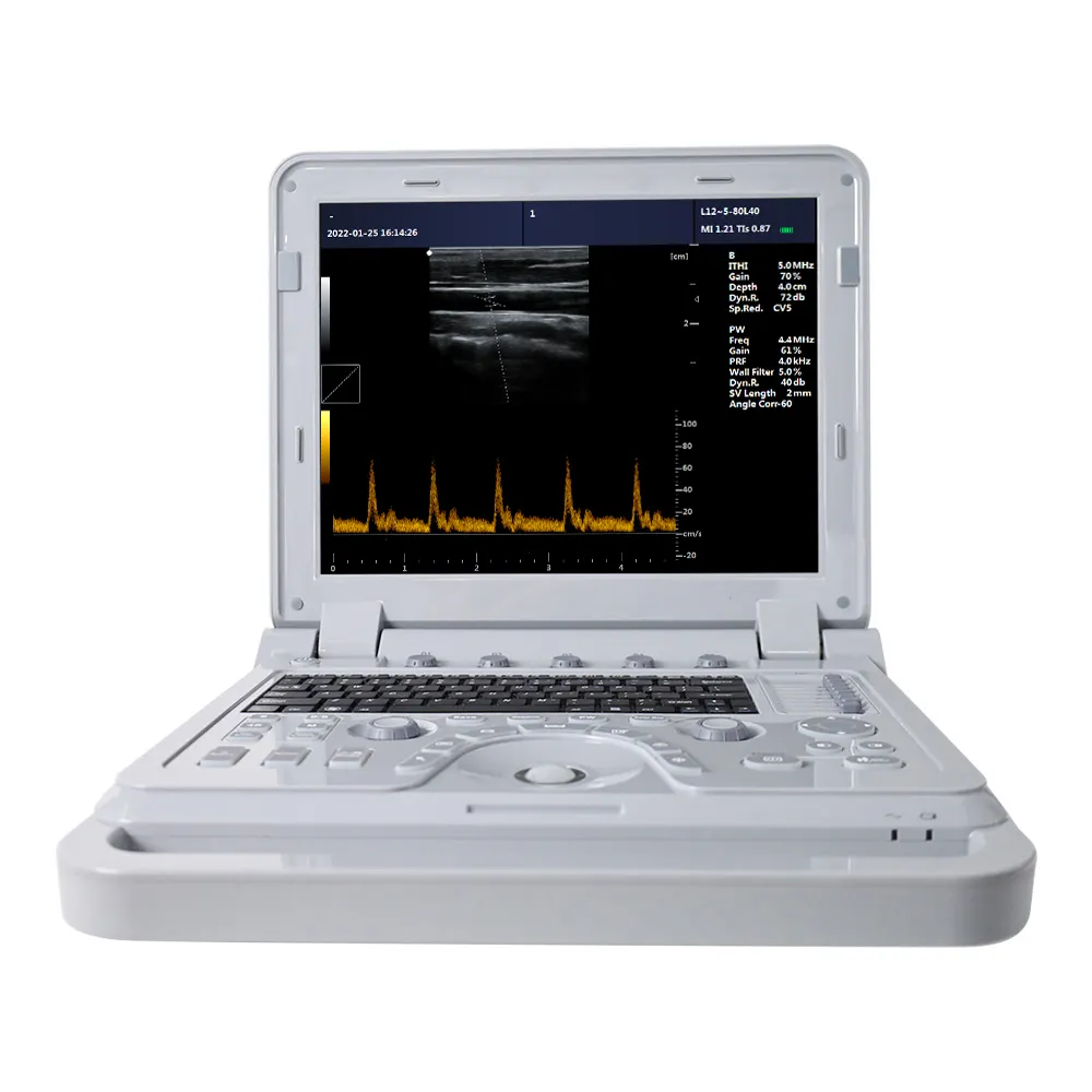 Contec CMS600P2PLUS-VET Ultrasound Apparatuur Ultrasound Scanner Veterinaire Ultrasound Machine