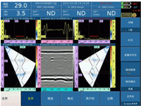 13.6 pouces TFT-LCD Numérique détecteur de défauts par ultrasons multiéléments