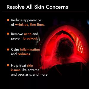 Appareil de beauté à 7 couleurs, masque facial à spectre sept couleurs, appareil de traitement de l'acné, instrument à spectre dédié - Product Image 3