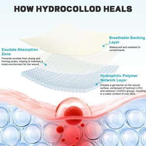 Pansement hydrocolloïde stérile auto-adhésif de qualité médicale, très absorbant, extra large, taille OEM, certifié CE, en rouleau, imperméable - Product Image 5