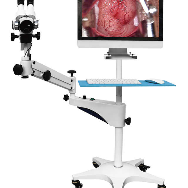 Colposcope System /Video Digital Colposcope with High Resolution Camera System