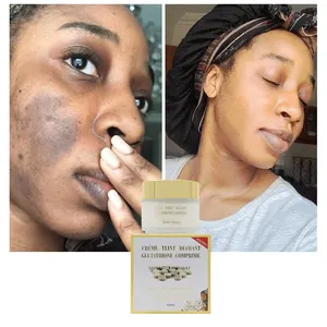 Crème pour le visage éclaircissant les taches brunes dissolvant soins de la peau crème blanchissante forte meilleurs produits de blanchiment de la peau du visage pour la peau noire