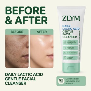 Nettoyant Visage Éclaircissant 12% Acide Lactique AHA Exfoliant Unifiant le Teint Doux pour les Taches Sombres <span class=keywords><strong>et</strong></span> Irrégulières - Product Image 3