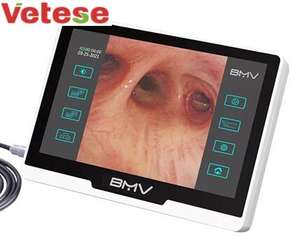 Equipamento Veterinário de Videogastroscópio Portátil Médico Sem Fibra Endoscópio Flexível de Estômago para Animais de Estimação - Product Image 2