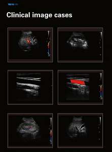 Dawei Medical Abdomen Ginecología Neonatal Máquina de ultrasonido de diagnóstico 4D <span class=keywords><strong>5D</strong></span> Trolley Color Doppler Electricidad 19 pulgadas de alto - Product Image 5
