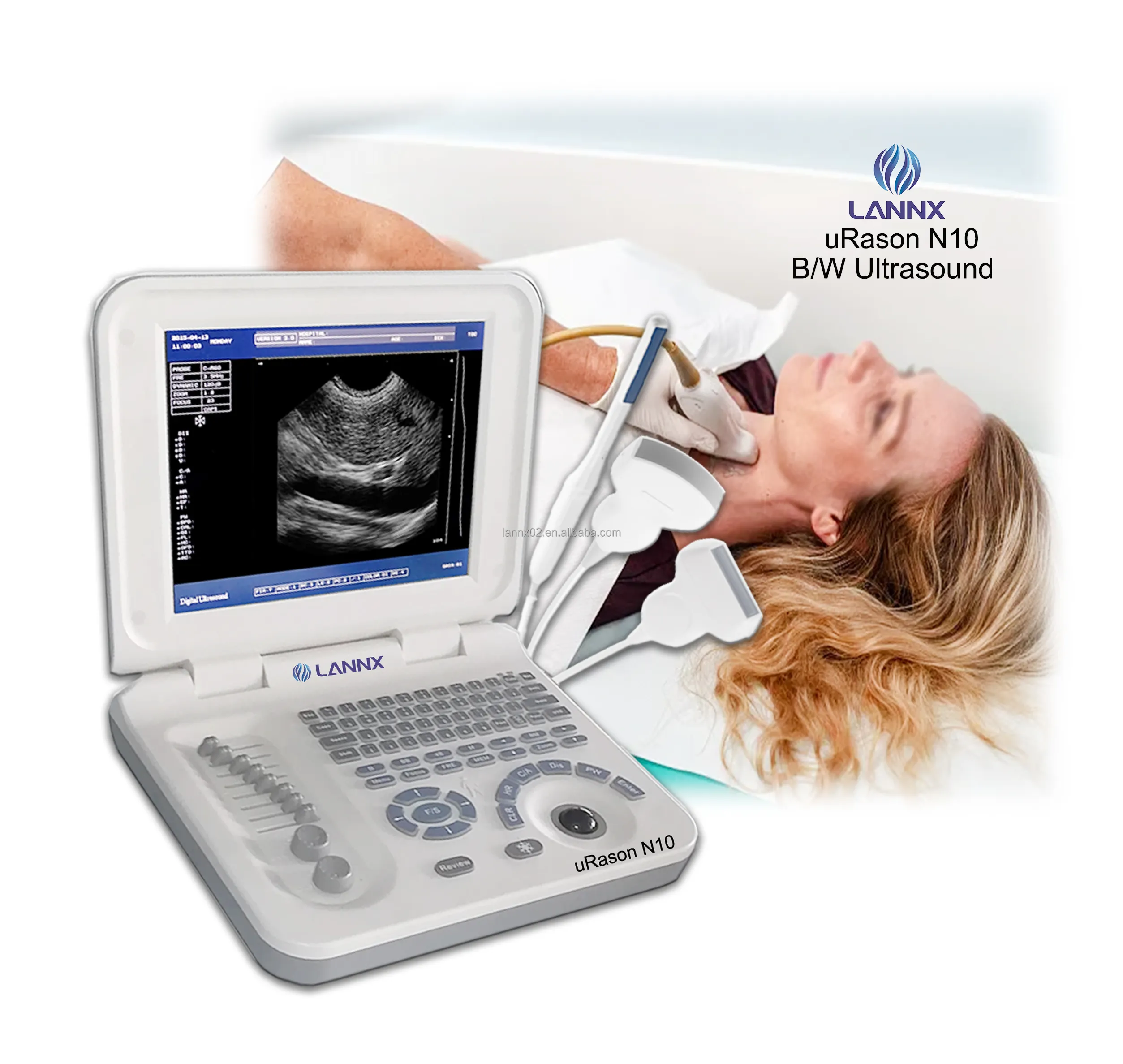 LANNX uRason N10 portatile portatile ecografo portatil strumenti medici ad ultrasuoni portatile Doppler Scanner ad ultrasuoni