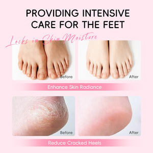 LAIKOU JAPON <span class=keywords><strong>SAKURA</strong></span> Vente en Gros Crème Anti-Crevasses Talons Très Secs 40g, Bâtonnet Hydratant Intense pour Soin des Pieds Rugueux - Product Image 6
