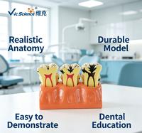 Modelo de Descomposición de Caries Dentales con Aumento 4X, Modelo Desmontable de la Estructura Interna del Diente Deciduado, CE/ISO/ROHS/CNAS