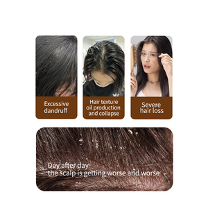 Huile capillaire personnalisée hydratante, nourrissante et lissante de haute qualité, rafraîchissante pour le cuir chevelu, contrôle du sébum, antipelliculaire à l'acide salicylique et à la noix de <span class=keywords><strong>coco</strong></span> - Product Image 3