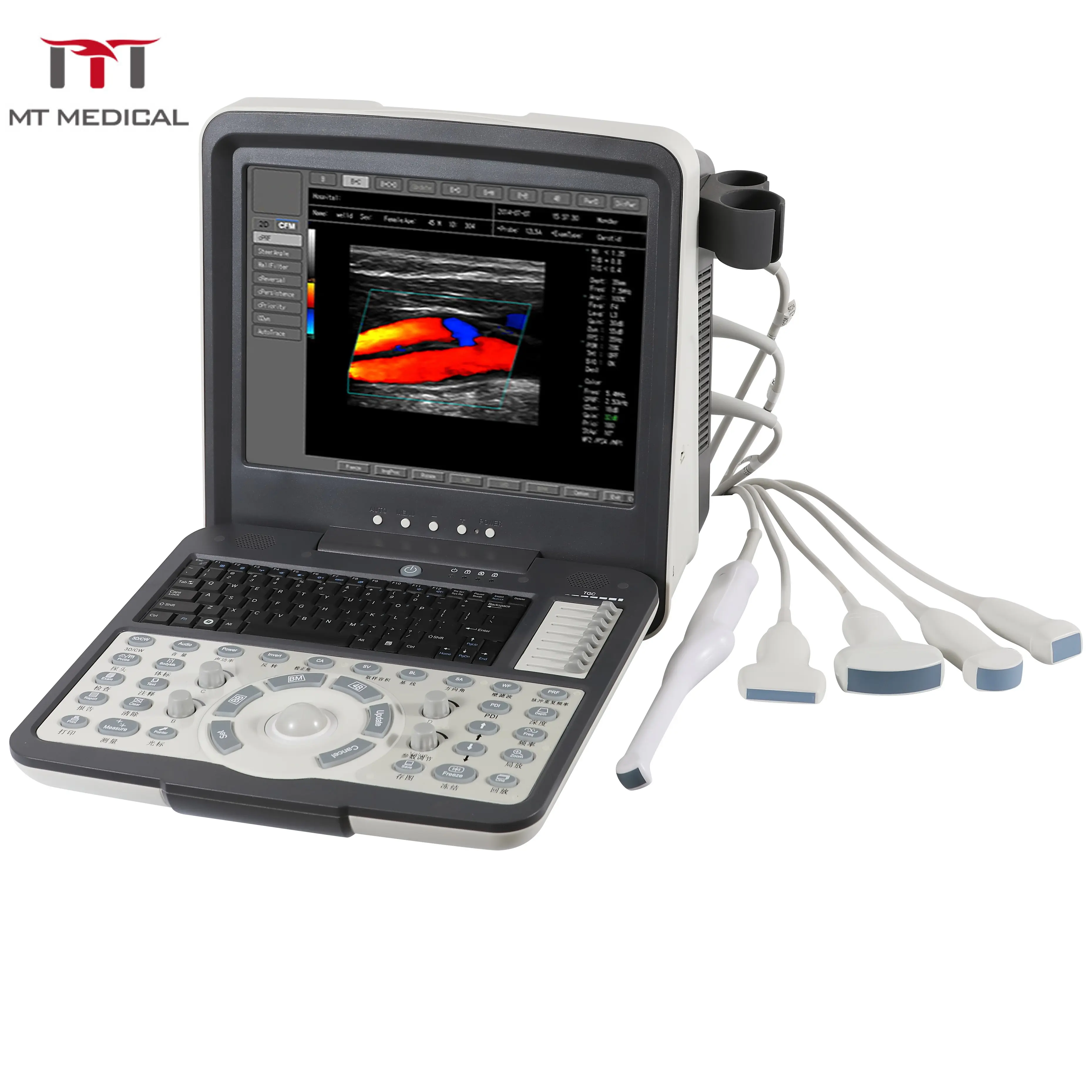 2020 Nieuw Type Hot Verkoop Laptop Draagbare Kleur Doppler Fysiotherapie Ultrasound Machine Gratis Onderdelen 2 Jaar Klasse Ii