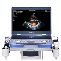 Appareil d'échographie vétérinaire numérique portable Mindray Vetus E7 - Instrument chirurgical réutilisable respectueux de l'environnement pour la chirurgie animale