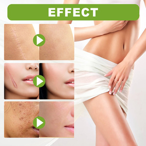 Suero Líquido Reparador de Cicatrices con Vitamina E, Fórmula Médica, Nutritiva, para Todo Tipo de Cicatrices, Quemaduras, Acné, Estrías, Uso Corporal - Product Image 3
