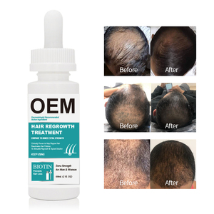 Kikland Liqual 5% Biotin Collagen Extra Strength Private Label Hair Growth Serum - Product Image 4