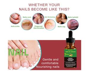 La onicomicosis <span class=keywords><strong>las</strong></span> <span class=keywords><strong>uñas</strong></span> <span class=keywords><strong>de</strong></span> <span class=keywords><strong>los</strong></span> pies <span class=keywords><strong>uñas</strong></span> eliminar <span class=keywords><strong>hongos</strong></span> en <span class=keywords><strong>las</strong></span> <span class=keywords><strong>uñas</strong></span> antibacteriano Reparación <span class=keywords><strong>de</strong></span> <span class=keywords><strong>uñas</strong></span> esencia - Product Image 6