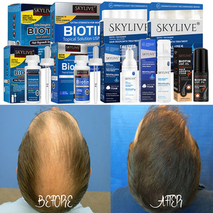 Nuevo diseño 60ml Espuma para el crecimiento del cabello para hombres Cuero cabelludo Romero Engrosamiento Tratamiento para el cabello Argan Rogain Biotin Espuma para la pérdida de cabello - Product Image 5