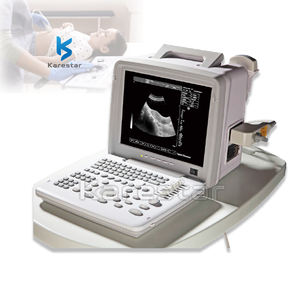 Échographie humaine haute définition spéciale pour la machine à ultrasons d'imagerie multi-parties des cliniques externes des hôpitaux - Product Image 1