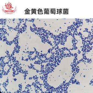 Cinco tipos de coxoides: comprensión preliminar de la morfología en la escuela de medicina; observación clara de bacterias microbianas - Product Image 5