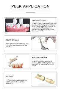 Tandheelkundige Materialen Peek Blok Voor Verwijderbare Prothese Beugel En Implantaten Met Goede Slijtvastheid Peek Disc Uit Loden Of China - Product Image 6