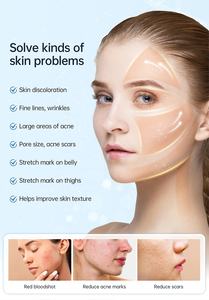 Nuevo Lápiz de Microagujas con Microcorriente Hydra <span class=keywords><strong>Pen</strong></span> H5 con Electroporación, Lápiz Dérmico para Uso Doméstico con Aplicador de Sueros - Product Image 5