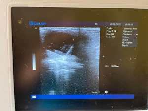 Longermay Veterinary Portable Touch Color Digital Doppler System Escáner de ultrasonido portátil - Product Image 4