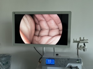 Sistema de cámara de endoscopio médico 2 en 1 de 1080P de fábrica directa <span class=keywords><strong>TUYOU</strong></span> para cirugía laparoscópica/ENT/personalizado - Product Image 6