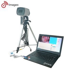 Digital <strong>Colposcope</strong> Video <strong>Colposcope</strong> Electronic <strong>Colposcope</strong> Microscopy Windows Software Cervical Imaging HD System - Product Image 4