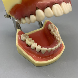 Oraal Model Voor Het Oefenen Van Parodontale Pathologie Tandheelkundige Calculusschaling - Product Image 5