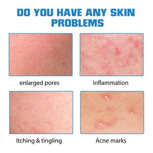 เซรั่มไฮยาลูรอนิกแอซิดสำหรับผิวหน้าเซรั่มช่วยให้ผิวหน้ากระจ่างใสช่วยให้ผิวขาวกระจ่างใส - Product Image 5