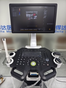 Escáner de Ultrasonido Doppler Color Tipo Carro, Económico, Dawei DW-F3, para Diagnóstico de Abdomen en Obstetricia y Ginecología - Product Image 4