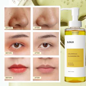 Aceite Limpiador Facial de Caléndula para el Cuidado Facial, Eliminación de Puntos Negros y Maquillaje, con Logotipo Personalizado de Fábrica - Product Image 6