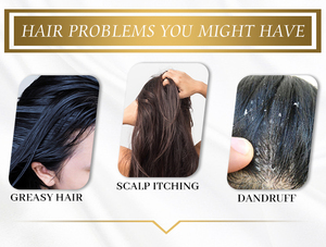 Shampooing antipelliculaire chimique de qualité supérieure pour cheveux fins secs et frisés frisés contenant de la crème aux acides aminés réparant les cheveux abîmés - Product Image 4