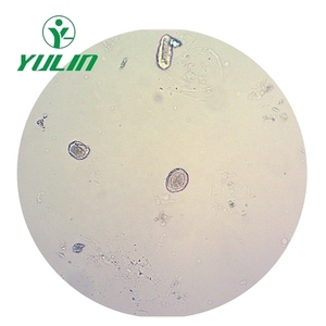 Vetrini per microscopio preparati per parassitologia rara verniciati professionali vetrini didattici di vendita calda in set di diapositive per biologia universitaria - Product Image 4