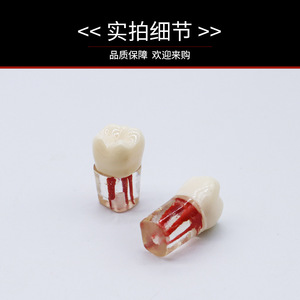 Modèles de dents en résine pour la pratique des examens dentaires, dents simulées avec canal radiculaire extrait, chambre pulpaire, équipements de nettoyage et de remplissage des dents - Product Image 4
