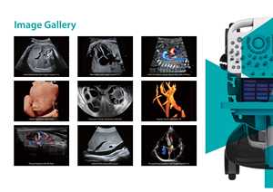 Système d'échographie sur chariot Sonoscape P40 Elite, best-seller, et échographie Doppler couleur pour la gynécologie, la cardiologie et l'utilisation vétérinaire - Product Image 2