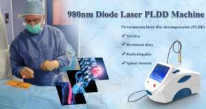 Solução de Laser Diodo para Descompressão de Disco Percutânea (PLDD) 980nm 1470nm, Máquina de Descompressão de Disco Lombar para Hérnia - Product Image 2