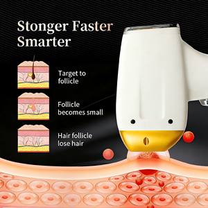 Máquina de Depilación Profesional de 4000W con Enfriamiento Vertical por Hielo, Sesiones Indoloras y Rápidas, Piel Suave de Larga Duración, Equipo de <span class=keywords><strong>Belleza</strong></span> - Product Image 4