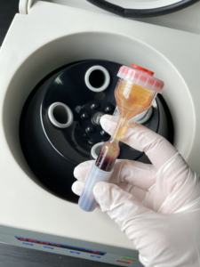 <span class=keywords><strong>Y</strong></span>-<span class=keywords><strong>tube</strong></span> tanpa zat tambahan, untuk tabung hewan peliharaan ortopedi rambut, steril - Product Image 5