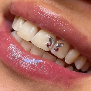 Accessoires dentaires en cristal coloré, <span class=keywords><strong>papillon</strong></span> en <span class=keywords><strong>strass</strong></span>, beauté, cristal plat, diamant dentaire, bijoux dentaires pour femmes et hommes - Product Image 2