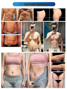Máquina Estimuladora Muscular Popular, Rejuvenecimiento de la Piel, Adelgazamiento Muscular, Quema de Grasa, Masajeador Corporal, Máquina Estimuladora para Gimnasio - Product Image 6