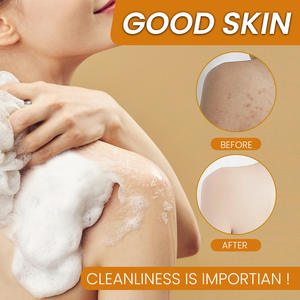 Private Label organico curcuma saponetta fatto a mano 100g di alleggerimento della pelle bagno sbiancante sapone rimozione dell'acne con ingredienti naturali - Product Image 5