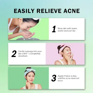 Creme facial para tratamento de acne salicílico de árvore de chá de Aloe Vera de hortelã-pimenta orgânica de marca própria