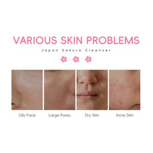 LAIKOU 50g Limpiador Facial Natural y Orgánico para el Cuidado de la Piel, Limpieza Profunda e Hidratante, Limpiador de Sakura Japonés - Product Image 2