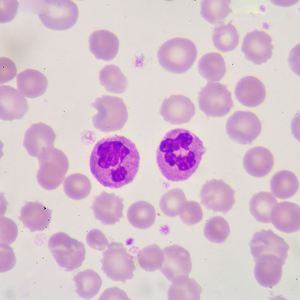 Reagente biochimico Stain Solutio Giemsa Stain / Giemsa Stainning Solution - Product Image 6